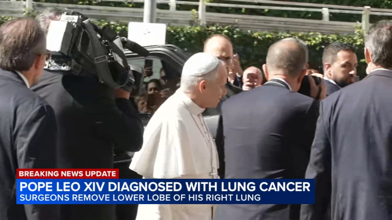 Pope surgery update: Vatican says Pope Leo XIV has lung cancer and the lower lobe of his right lung was removed
       — ABC 7 Bay Area, Burlingame Community news